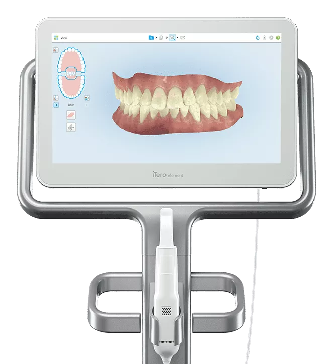 Itero Intraoral Scanning Technology