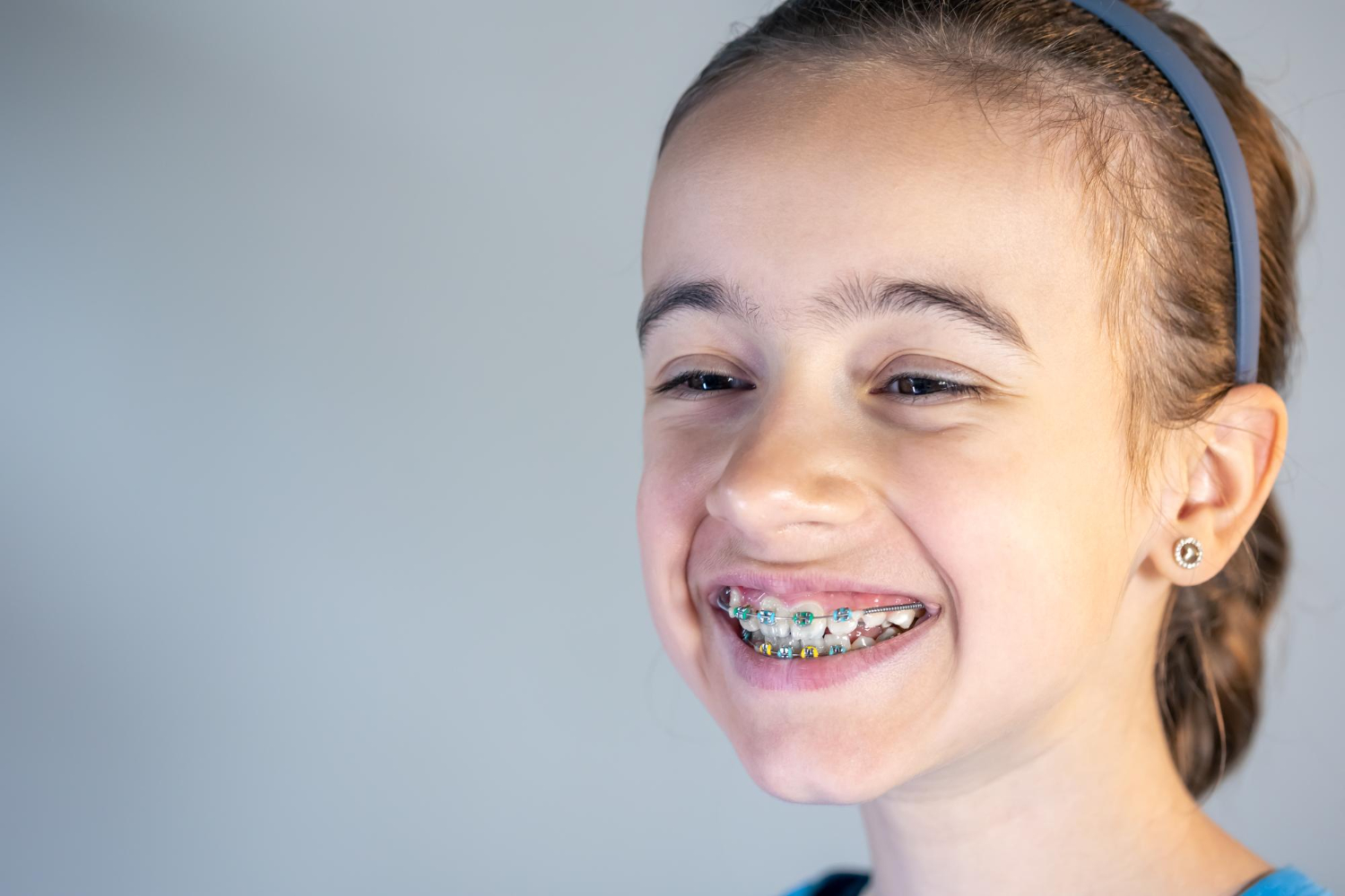 Early Intervention with Dental Braces