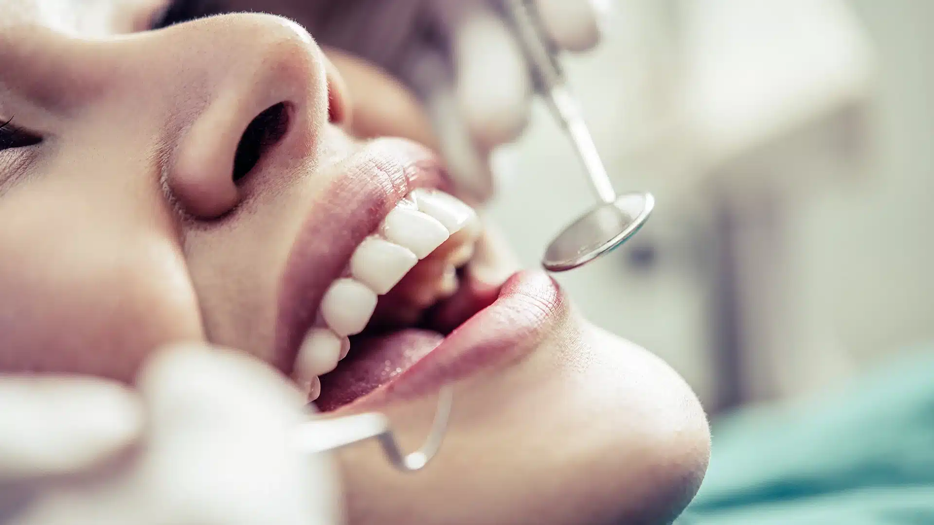 dental crowns