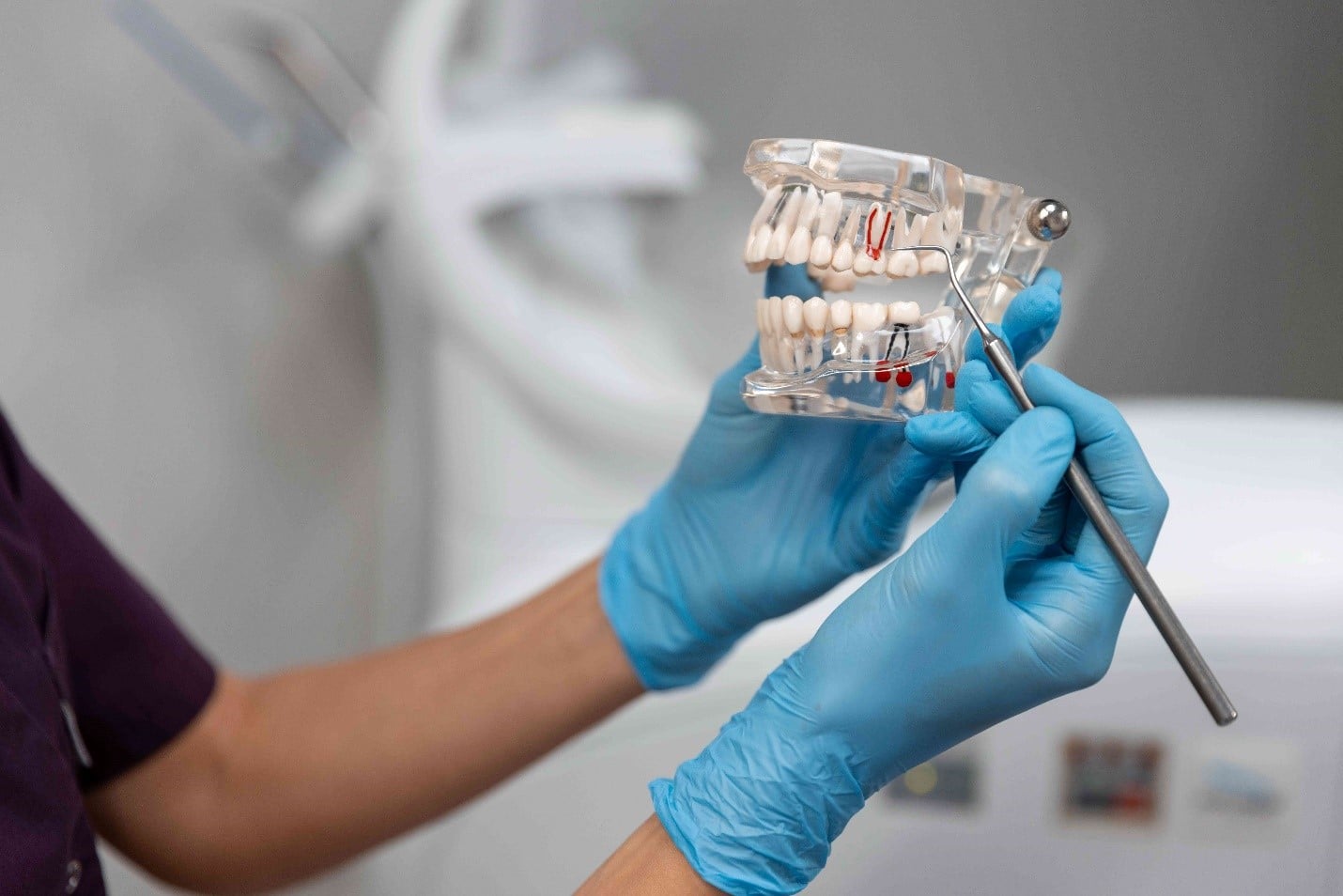 dental implants side effects - Garden Dental Clinic