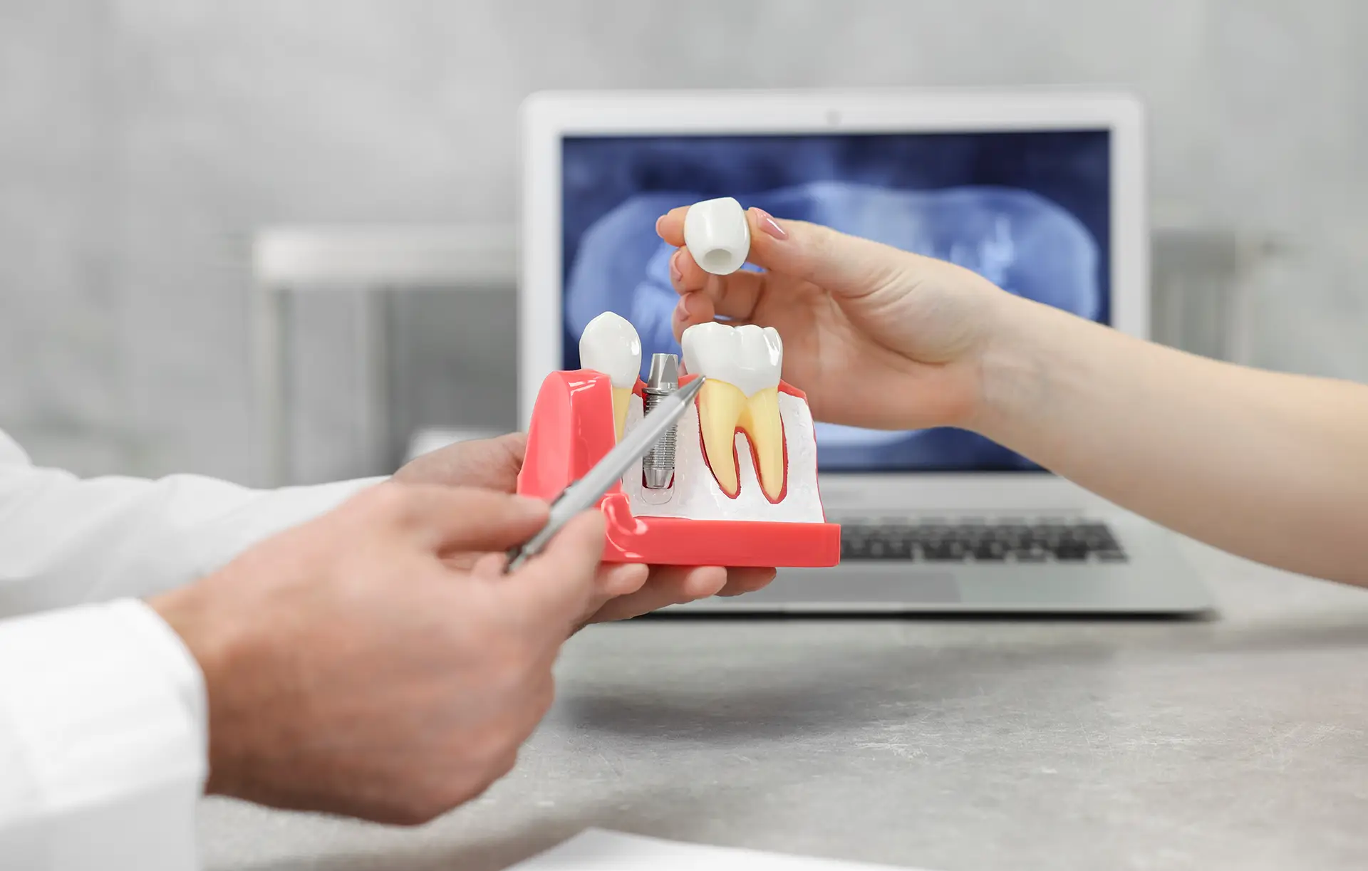 Garden Dental Doctor showing patient educational model of dental implant in clinic