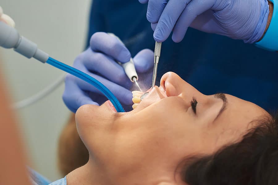 Close-up of a root canal treatment in Singapore - Garden Dental